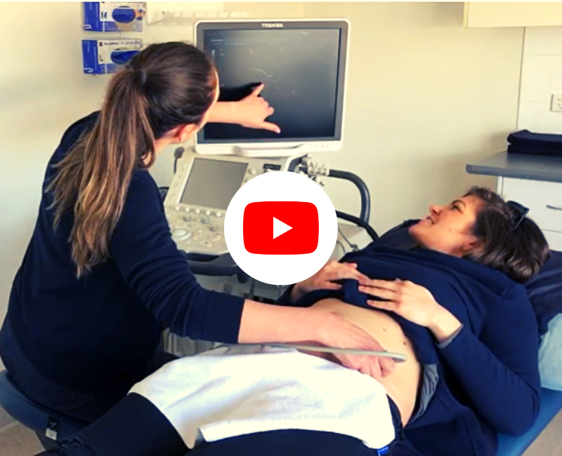Watch the new video that celebrates sonographers and the work you do